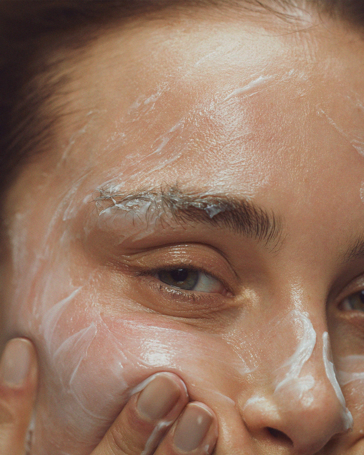 Skin purging and why it’s actually a good thing